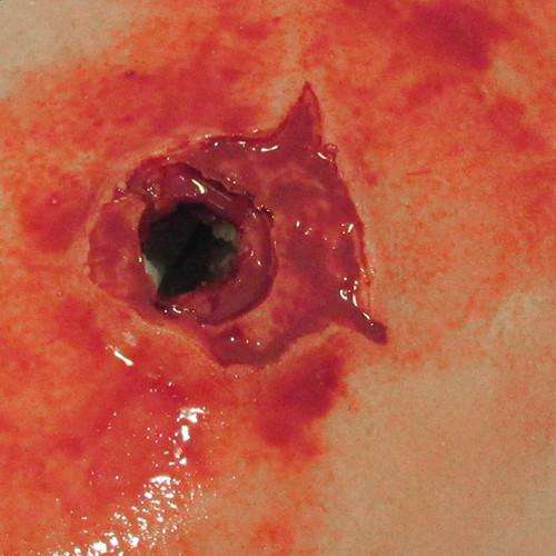 5160-GSW-wound-detail-500-1024x1024.3430ed.jpg