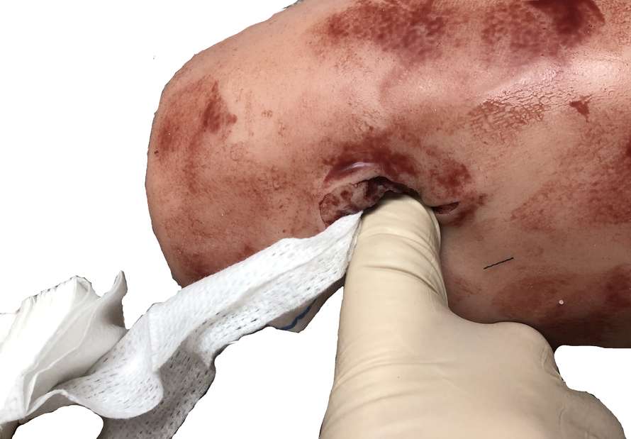 Woundpack QuikClot 2